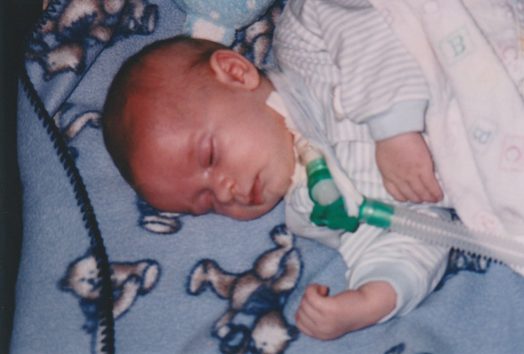Kyle at home, on the ventilator